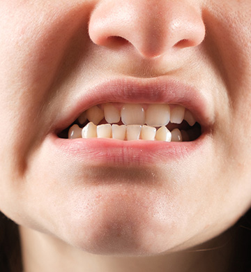 What causes TMJ disorders