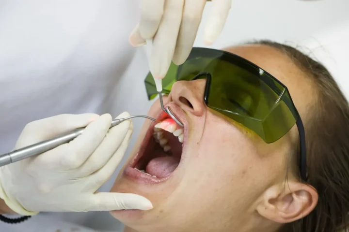 Laser Dentistry for Gum Disease: All Gain, No Pain