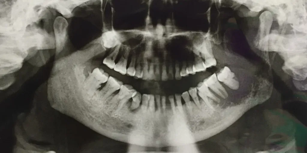 the-importance-of-screening-for-oral-cancer