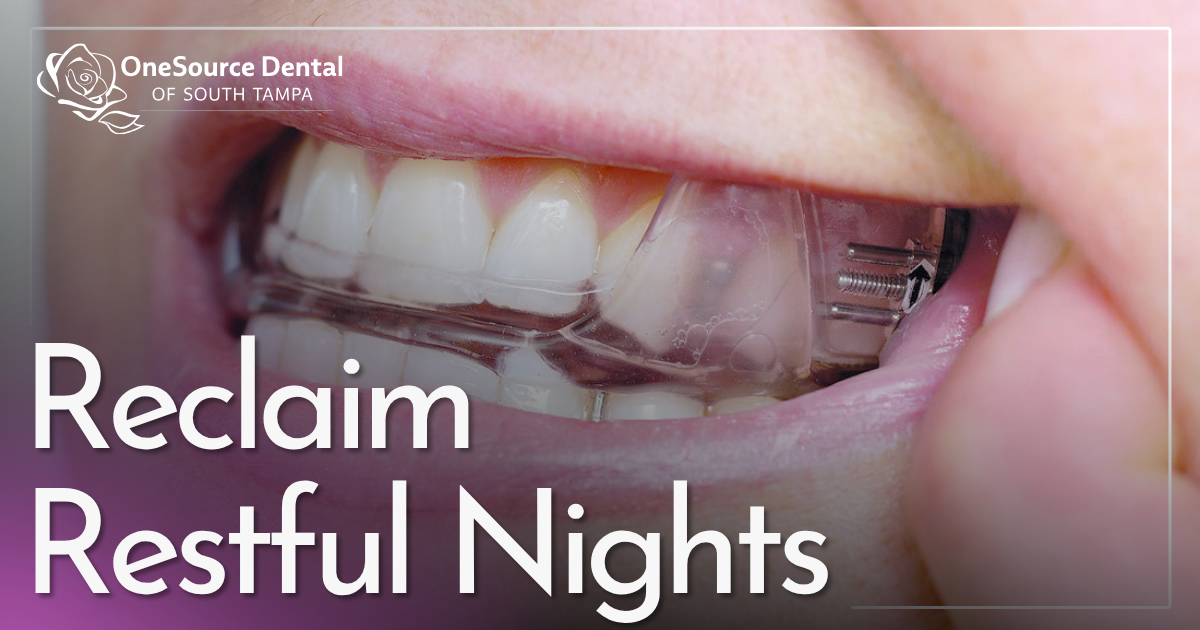 Reclaim Restful Nights mouth wearing night guard